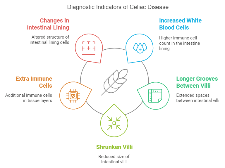 A circular diagram titled "Diagnostic Indicators of Celiac Disease" highlighting five key indicators observed through endoscopy. The indicators are changes in intestinal lining, increased white blood cells, extra immune cells, shrunken villi, and longer grooves between villi, each illustrated with icons and bright colors.