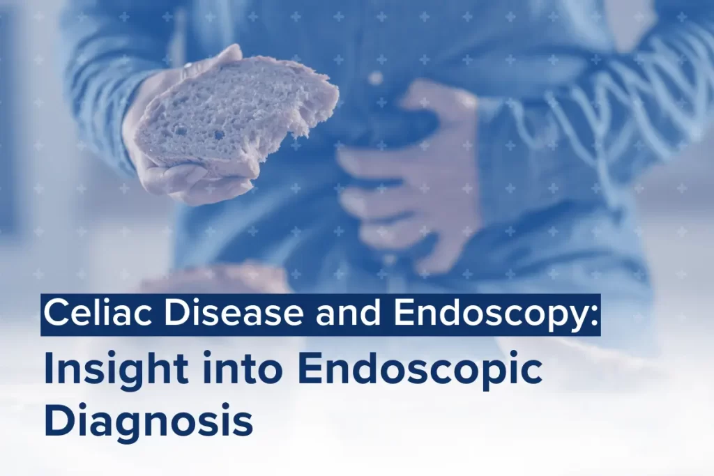 A close-up image of a person holding a slice of bread in one hand while clutching their abdomen with the other, symbolizing the discomfort associated with celiac disease. The overlay text reads: "Celiac Disease and Endoscopy: Insight into Endoscopic Diagnosis."