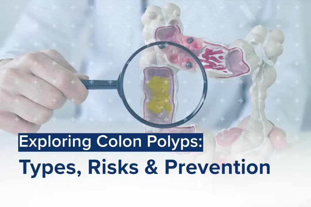 Exploring Colon Polyps: Types, Risks, and Prevention