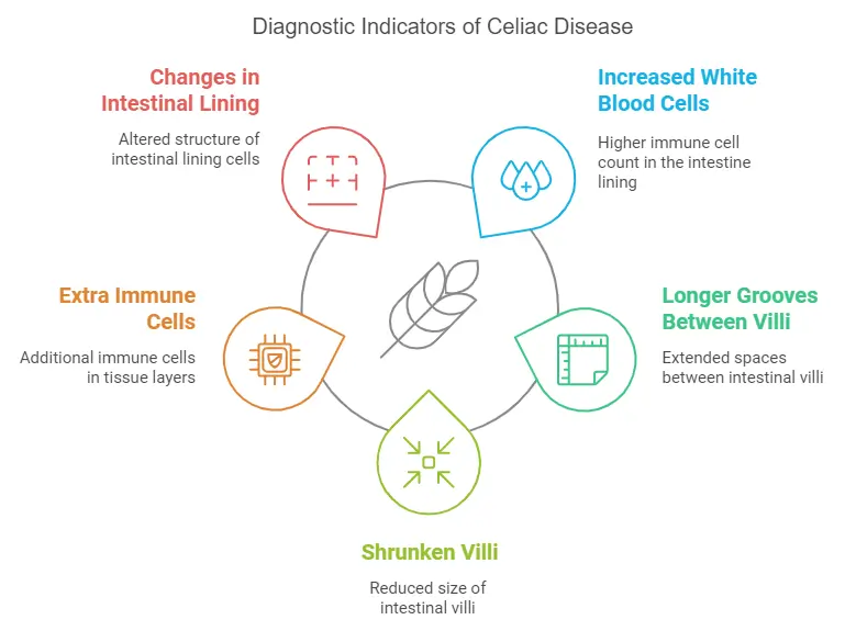 A circular diagram titled "Diagnostic Indicators of Celiac Disease" highlighting five key indicators observed through endoscopy. The indicators are changes in intestinal lining, increased white blood cells, extra immune cells, shrunken villi, and longer grooves between villi, each illustrated with icons and bright colors.